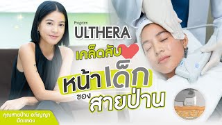 ULTHERA | เคล็ดลับหน้าเด็กของคุณสายป่าน  อภิญญา | ผิวยกกระชับ