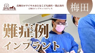 梅田でインプラントは難症例の実績も多い北梅田ロワイヤルおとなこども歯科