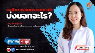 วงสีขาวรอบกระจกตาดำ บ่งบอกอะไร?