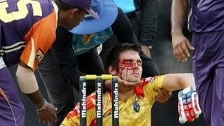 Top 10 Dangerous Balls in Cricket History ★ Must Watch Batsman Blood Outs★