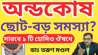 অন্ডকোষের সমস্যা । অন্ডকোষ ছোট  ও হোমিওপ্যাথি চিকিৎসা । Testes ।Dr Tarun Mondal.