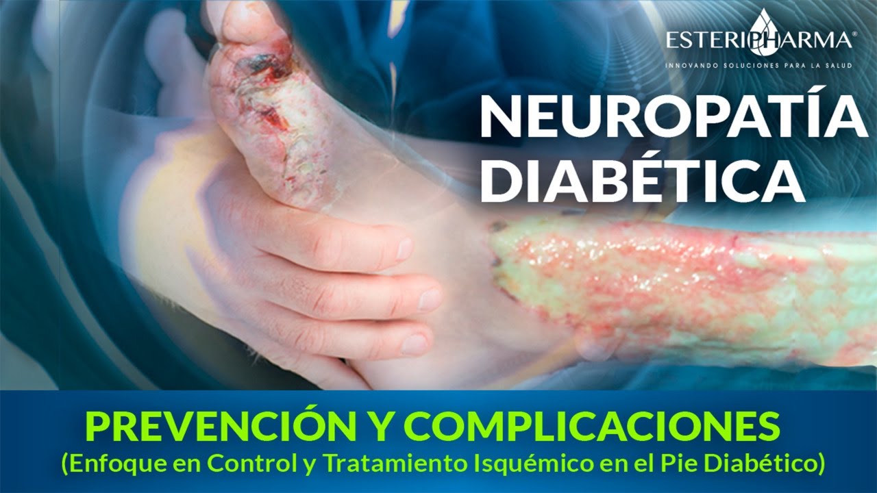 Neuropatía Diabética. Prevención Y Complicaciones - YouTube