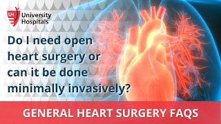 Do I need open heart surgery or can it be done minimally invasively?