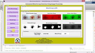 Blood Group Identification Using Image Processing Matlab Project Code