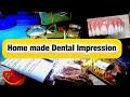 How to take Alginate Impressions