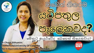 යටිපතුල් පැලීම සදහා ආයුර්වේදීය විසදුම්|ayurveda treatment for feet cracking|footcrack|suwahasClinic