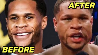 Devin Haney BEFORE & AFTER getting BUSTED UP & BEATEN by Ryan Garcia