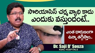 సోరియాసిస్ ఎలా ఉన్నా తగ్గిస్తాం..| Psoriasis Treatment | Dr Saji D'Souza | KSAC Hospitals | PlayEven