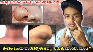 ಒಂದು ವಾರದಲ್ಲಿ ಈ ಕಪ್ಪು ಗುರುತು ಮಾಯಾ ಮಾಡಿ | How To Remove Black Heads \u0026 Dark Areas Private Parts, Elbow