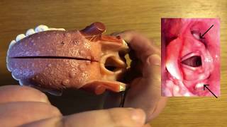 Laryngeal Anatomy Part 2: internal anatomy of larynx and laryngopharynx