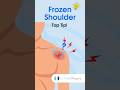 Frozen Shoulder Top Tip #physicaltherapy #physiotherapy #adhesivecapsulitis