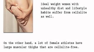 Cellulean Cellulite Gel