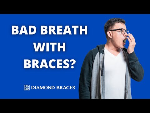 Can Braces Cause Bad Breath? Can Braces Cause Bad Breath?
