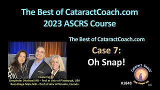 CataractCoach™ 1848: ASCRS 2023 Course Case 7 Oh Snap (Cataract Snap Sign)