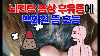 뇌진탕 증상 후유증에 백회혈 뜸 효능, 8체질연구소 294회