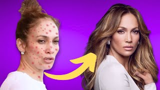 Jennifer Lopez (54 Yrs Old) Shares her insights for Anti-Aging Secrets | Gaining A Glowing Skin