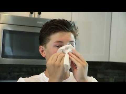 Can dehydration cause nose bleeds?