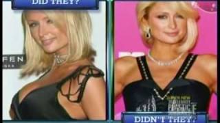Does Paris Hilton Have Breast Implants?