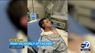 Larchmont man's ear sliced off in violent attack outside his home
