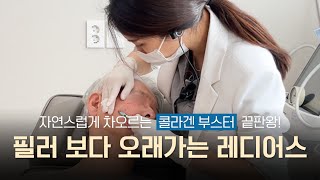 필러 보다 오래가는 레디어스 ㅣ 이물감 없이 자연스러운 콜라겐 부스터 #청담동피부과 #에스엔브이의원