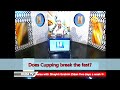 Does Cupping break your fast? - Sheikh Assim Al Hakeem