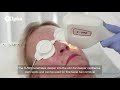 alpha system 808nm diode laser 3d ipl introduction video