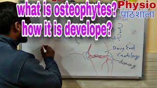 Osteophytes? how it is develope??