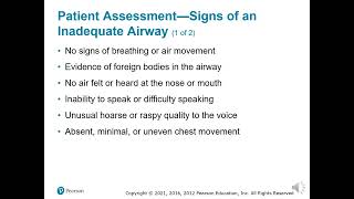 Chapter 9 Airway Management