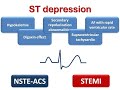 ECG course: ST segment depression (ischemia & others), Dr. Sherif Altoukhy