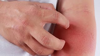 DERMATOLOGY - LEC 1 - DIAGNOSIS OF SKIN DISEASES