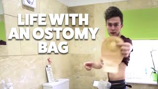 Life with my Ostomy Bag | Ileostomy Vlog