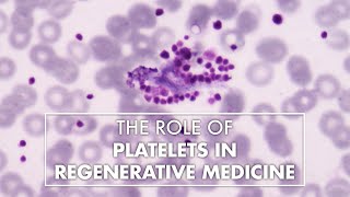 The Role Of Platelets In Regenerative Medicine | Dr. Amit Mirchandani | Top10MD