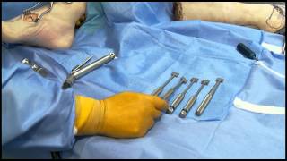 Cotton Osteotomy