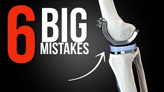 6 MISTAKES You Should NEVER Make After Knee Replacement