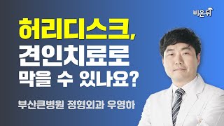 [부산] 허리디스크, 견인치료로 막을 수 있나요? / 부산큰병원 정형외과 우영하