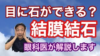 「結膜結石のお話」【東戸塚　片桐眼科クリニック】