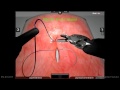 da Vinci Surgery - Skills Simulator - Interrupted Suture