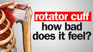How BAD Does a Torn Rotator Cuff Actually Feel?