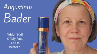 Using Augustinus Bader On Half My Face For 12 Months - Did It Help?