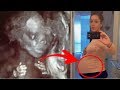 Woman’s Baby Bump Keeps Growing Then Doctor Spots Something Unusual In Ultrasound