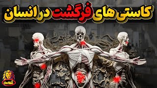 فرگشت و اشتباهات بسیاری که هنوز در بدن ما وجود دارد - قسمت دوم