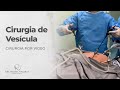 Cirurgia Real de Vesícula por Vídeo