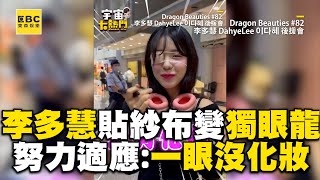 李多慧貼紗布變「獨眼龍」！努力適應視差笑喊：一眼沒化妝 @cosmosviral