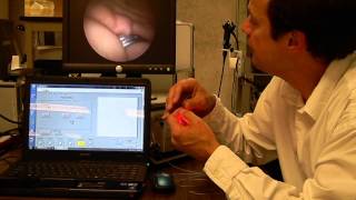 Scanning Fiber Endoscope
