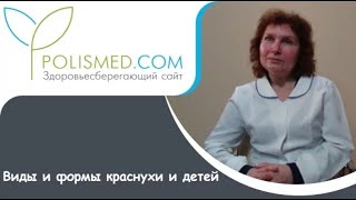 Виды и формы краснухи: врожденная, приобретенная, бессимптомная, ложная, острая и хроническая