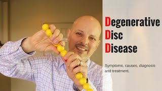 Degenerative Disc Disease Causes and Treatment