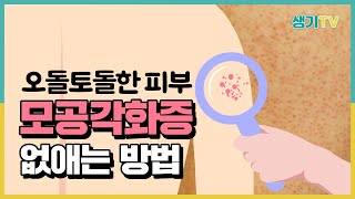 모공각화증의 치료와 홈케어 방법!