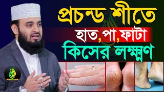 যাদের হাত পা ফাটে ওয়াজটি তারা ১বার হলেও শুনুন?, mizanur rahaman azhari, তারিখ 16 Dec 2024