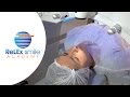 ReLEx smile Academy: Lenticule creation Step 1 to 4