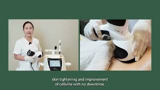 Viora V-Form | Skin Tightening |Confidence in Beauty